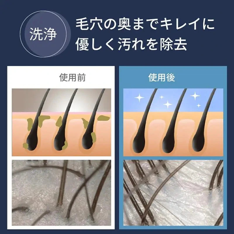 NOREVA ナノバブルシャワー 毛穴洗浄・節水92%・高水圧ミスト【2026年最新版】