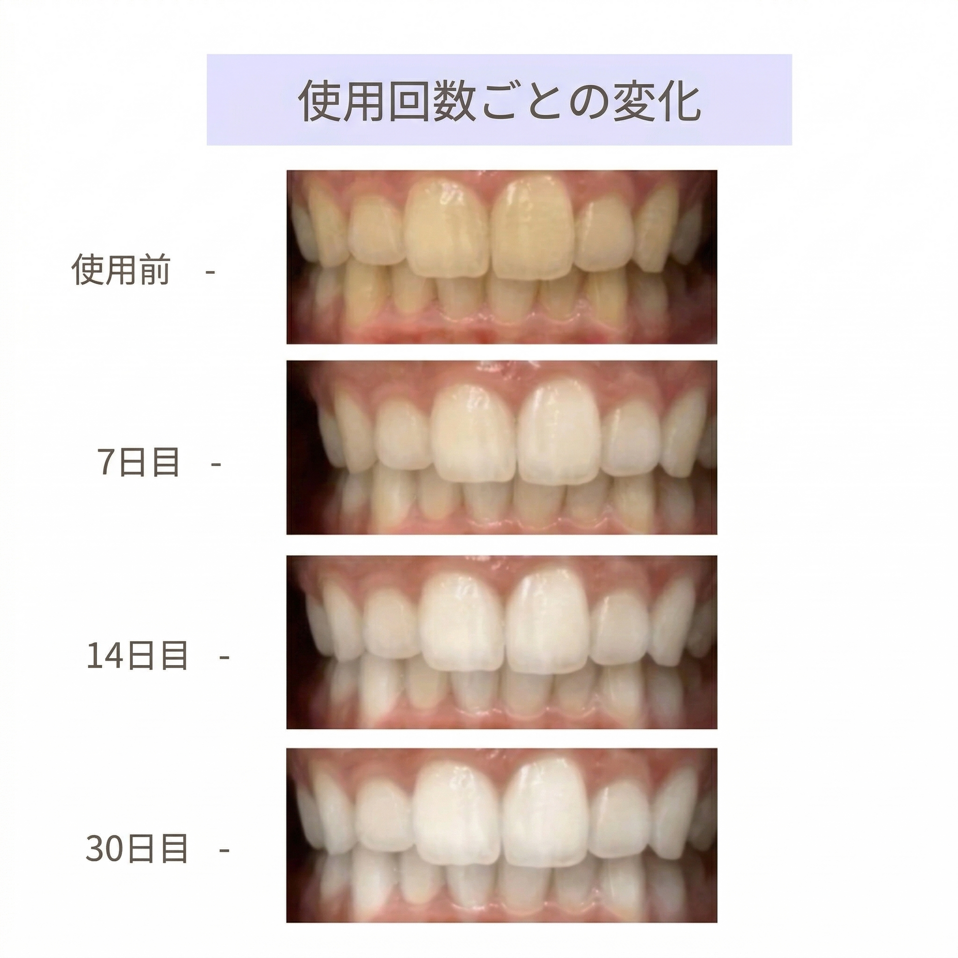 CEELIKE ホワイトニングシート|30分ケア – noreva CEELIKE ホワイトニングシート|30分ケア – noreva