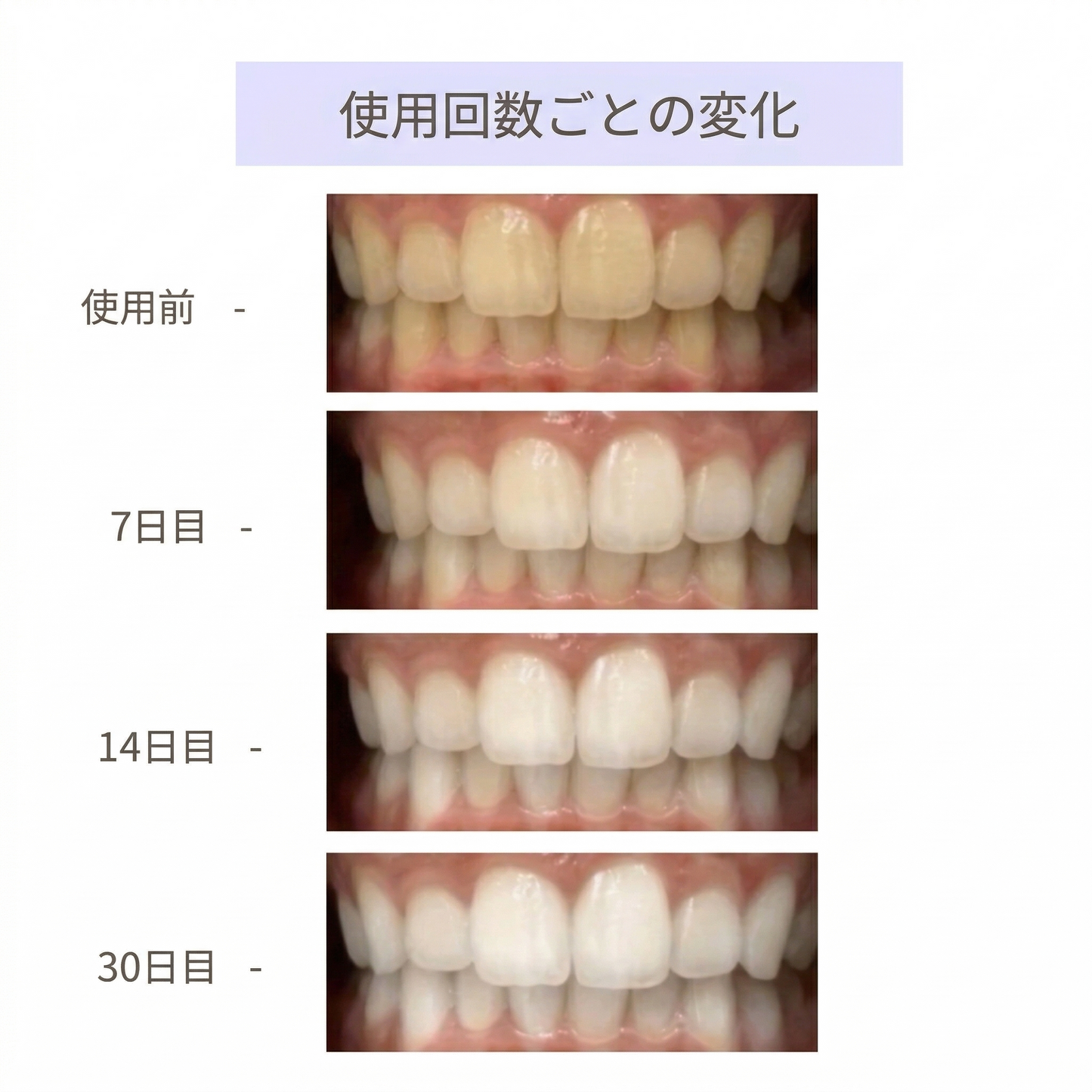 CEELIKE ホワイトニングシート｜過酸化物不使用。歯科医院級の白さを、 自宅で・やさしく・30分で。